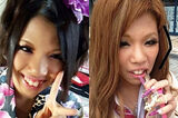 "Three years ago, it was said that the horse face ugly ..." A model with a total plastic surgery total of over 20 million yen, a drastic change in cosplay before and after plastic surgery